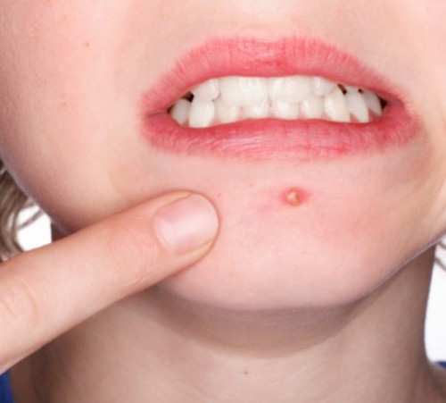 screenshot-www.google.no 2015-12-15 00-20-58