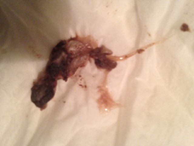 Skýringarmynd sem sýnir ætlaða útskolun eiturefna að lokinni notkun