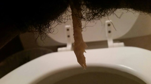 Þessa skýringarmynd má sjá á vefsíðu fyrirtæksins; notaður, afeitrandi jurtapoki