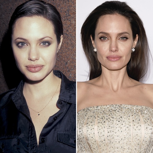 Angelina Jolie hefur aldrei tjáð sig um nefaðgerð en lýtalæknar telja það mjög öruggt að hún hafi farið í aðgerð