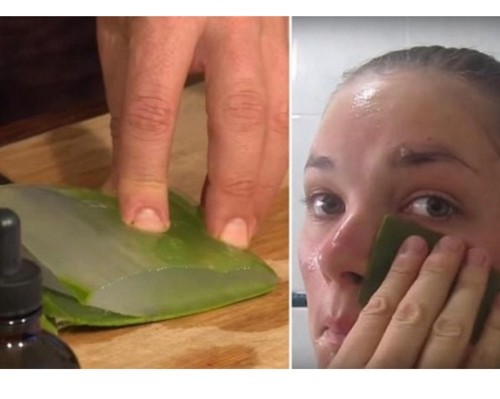 aloe vera